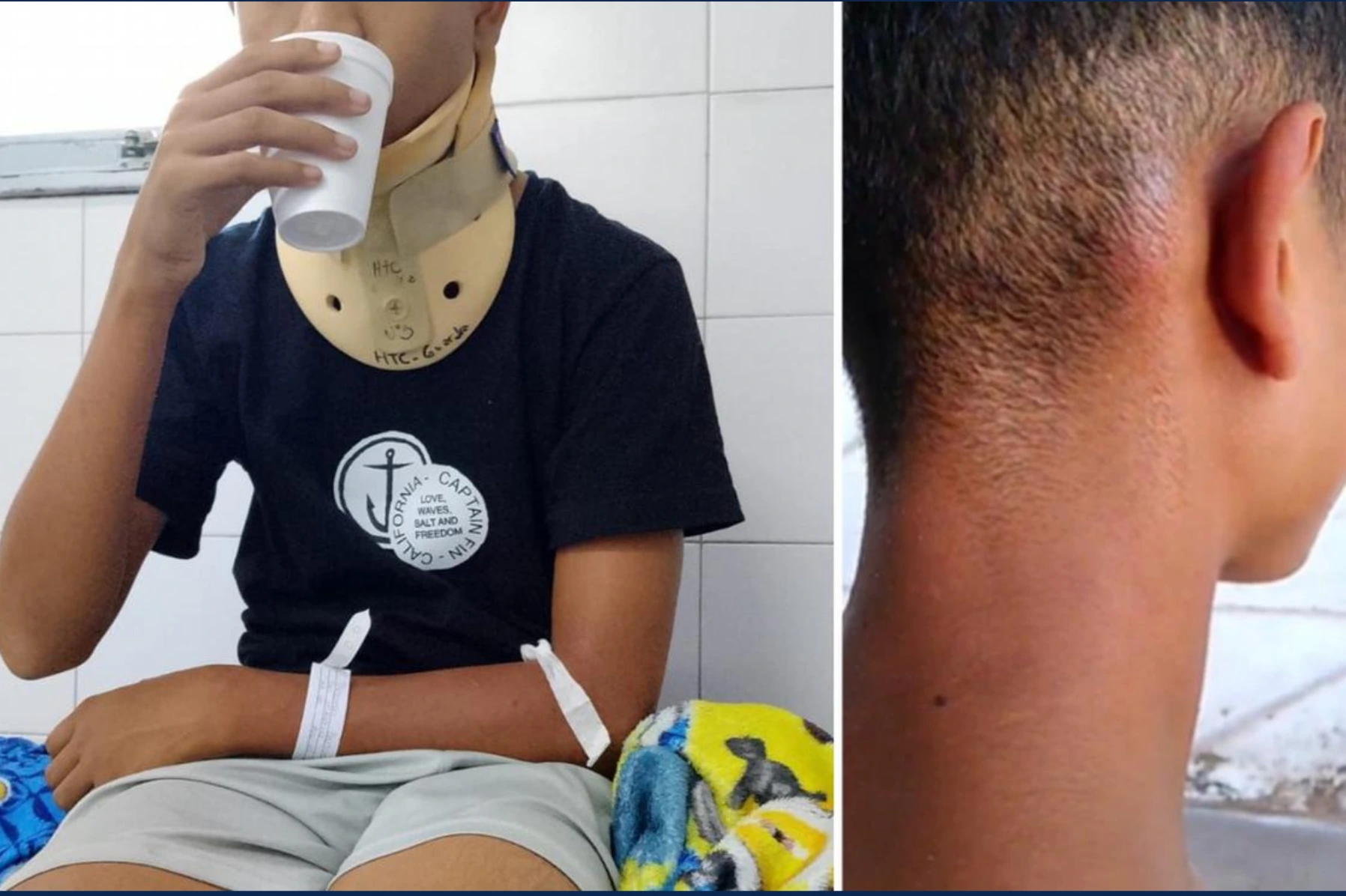 Brutal agresión en un colegio de Córdoba: Un alumno con epilepsia fue atacado a patadas