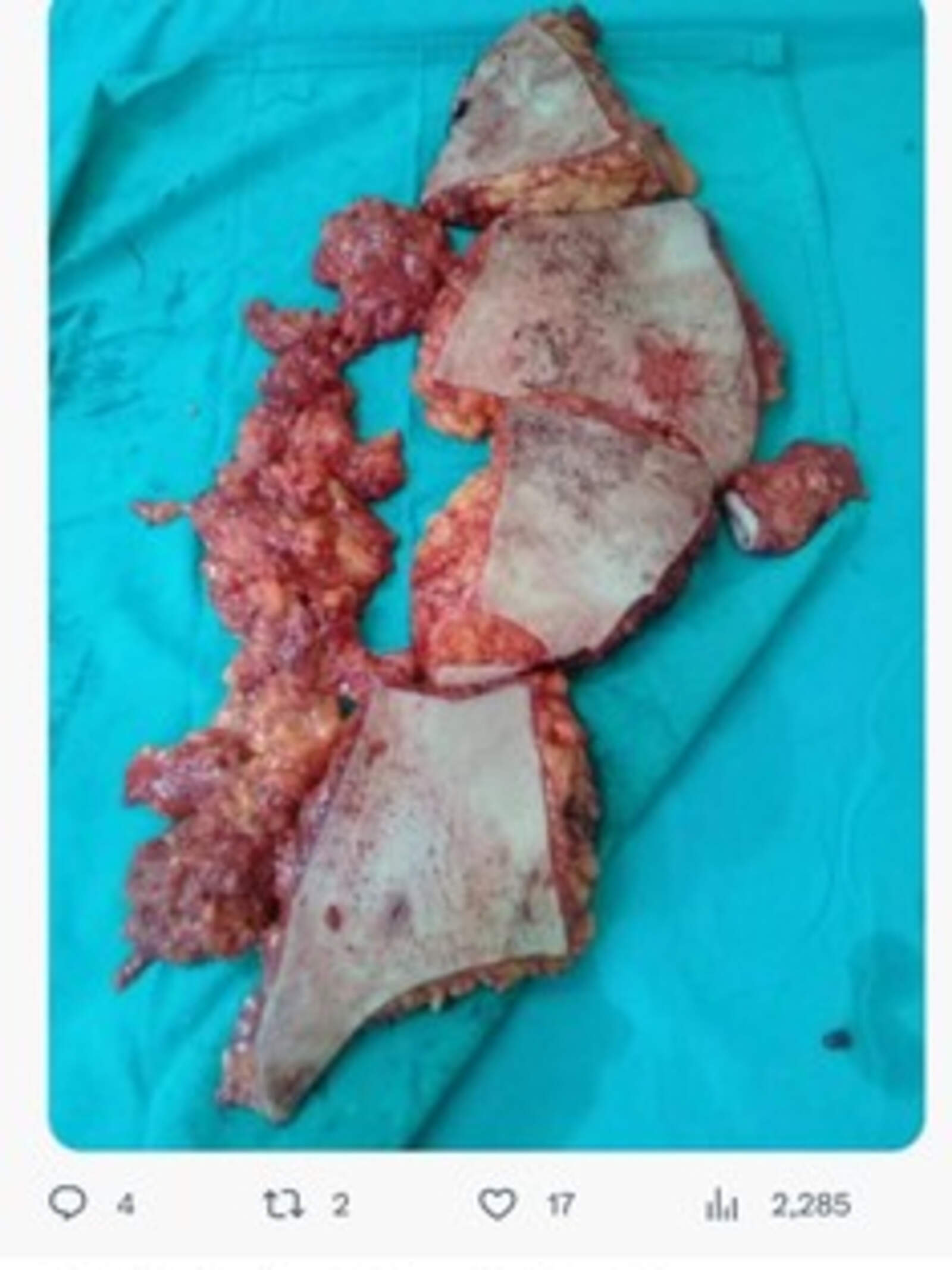 El posteo borrado de Toviggino