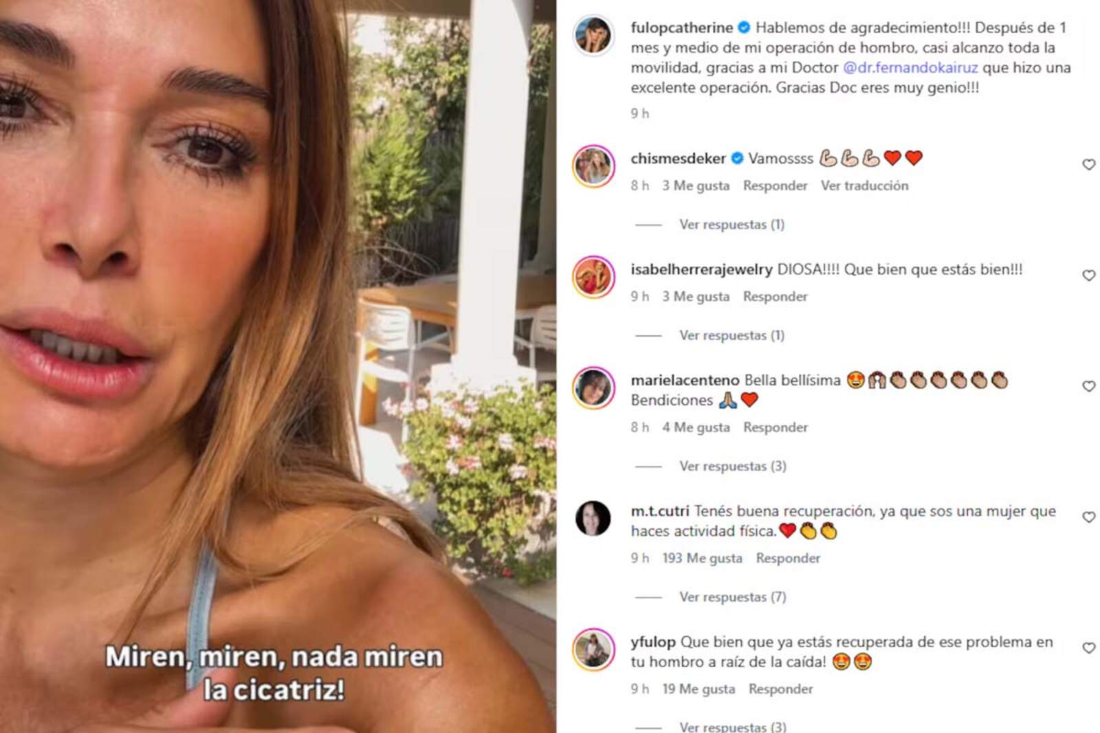 Catherine Fulop atraviesa un proceso de recuperación luego de la operación de hombro 