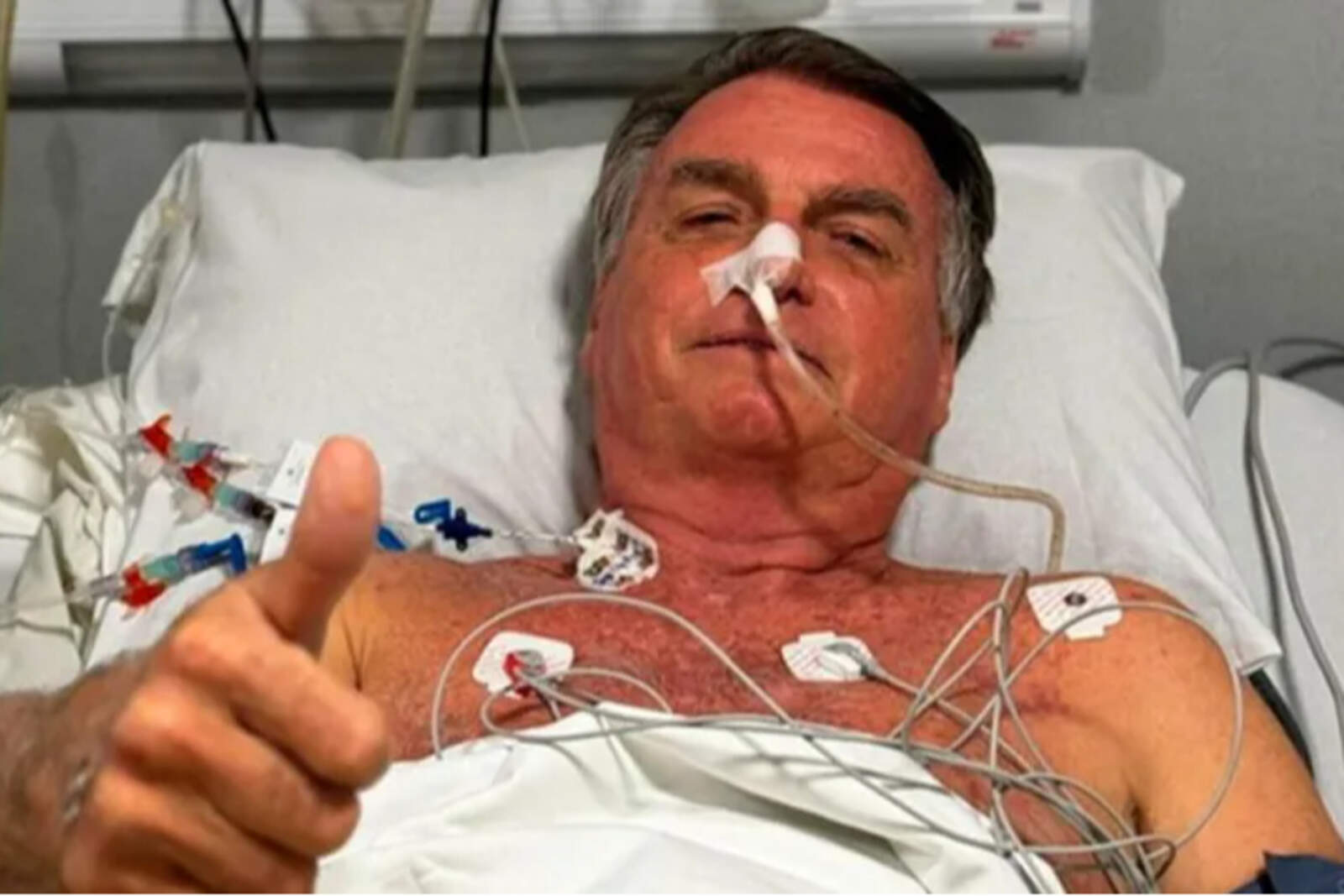 Bolsonaro fue recientemente operado por una hernia inguinal, producto del atentado que sufrió en 2018