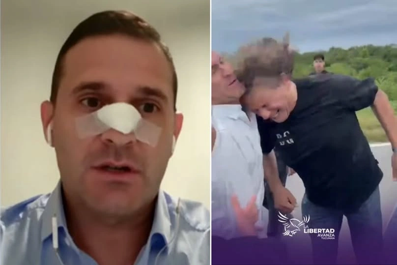 Deputy Pelli revealed details of the attack and exposed links with local power