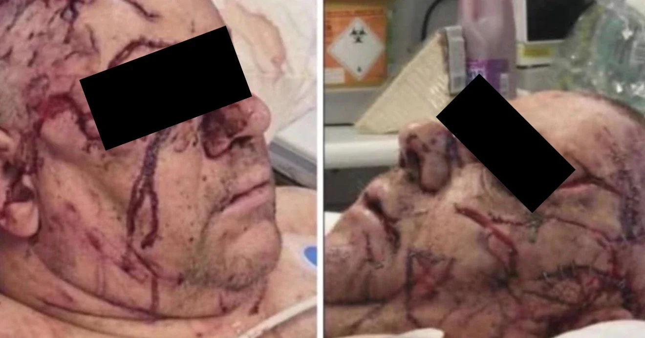 Stephen Ogilvie in the hospital after the attack