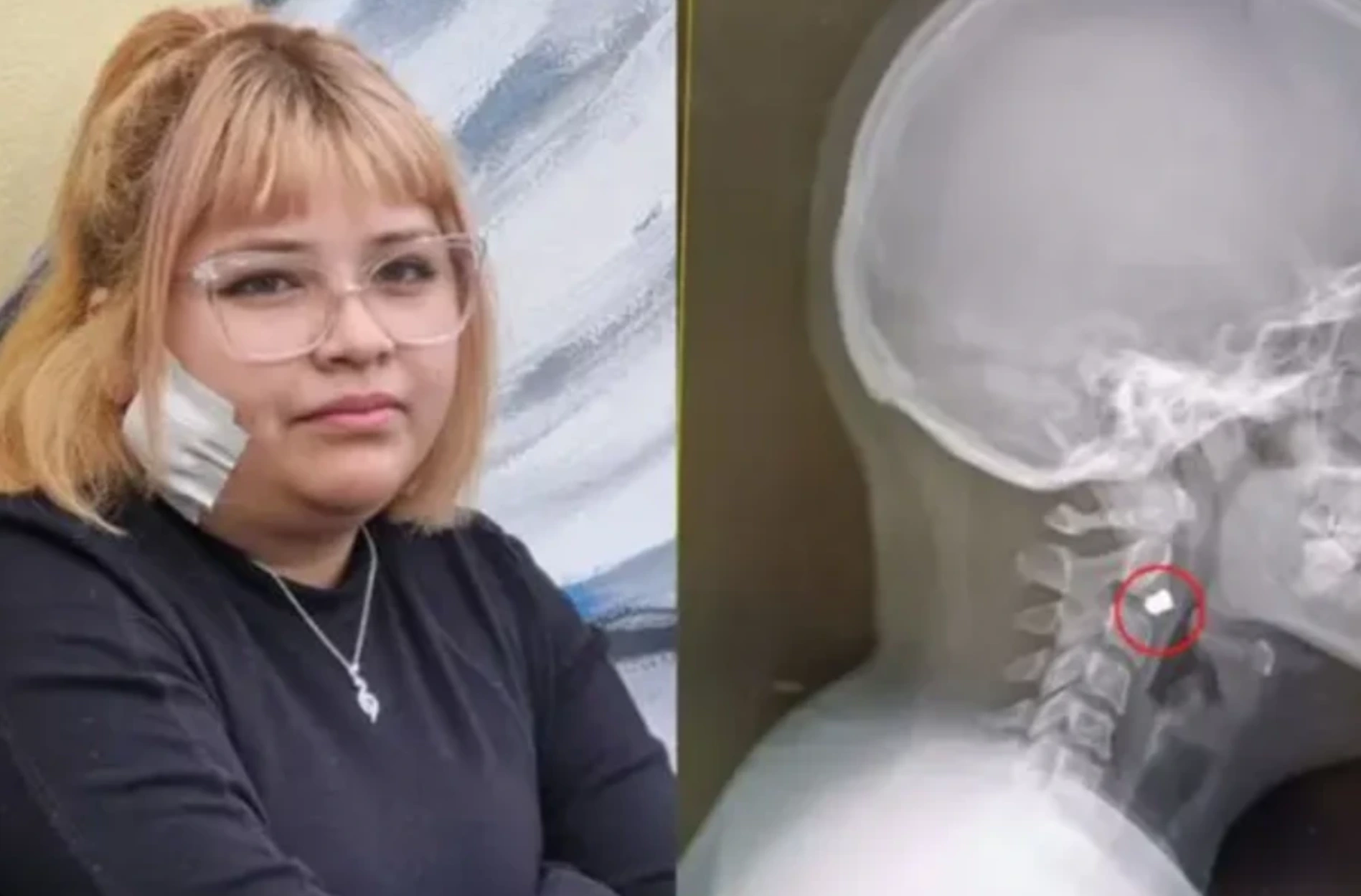 a Justicia aplicó la carátula de lesiones leves doblemente calificadas, sumando los agravantes de haber actuado por placer y con alevosía.