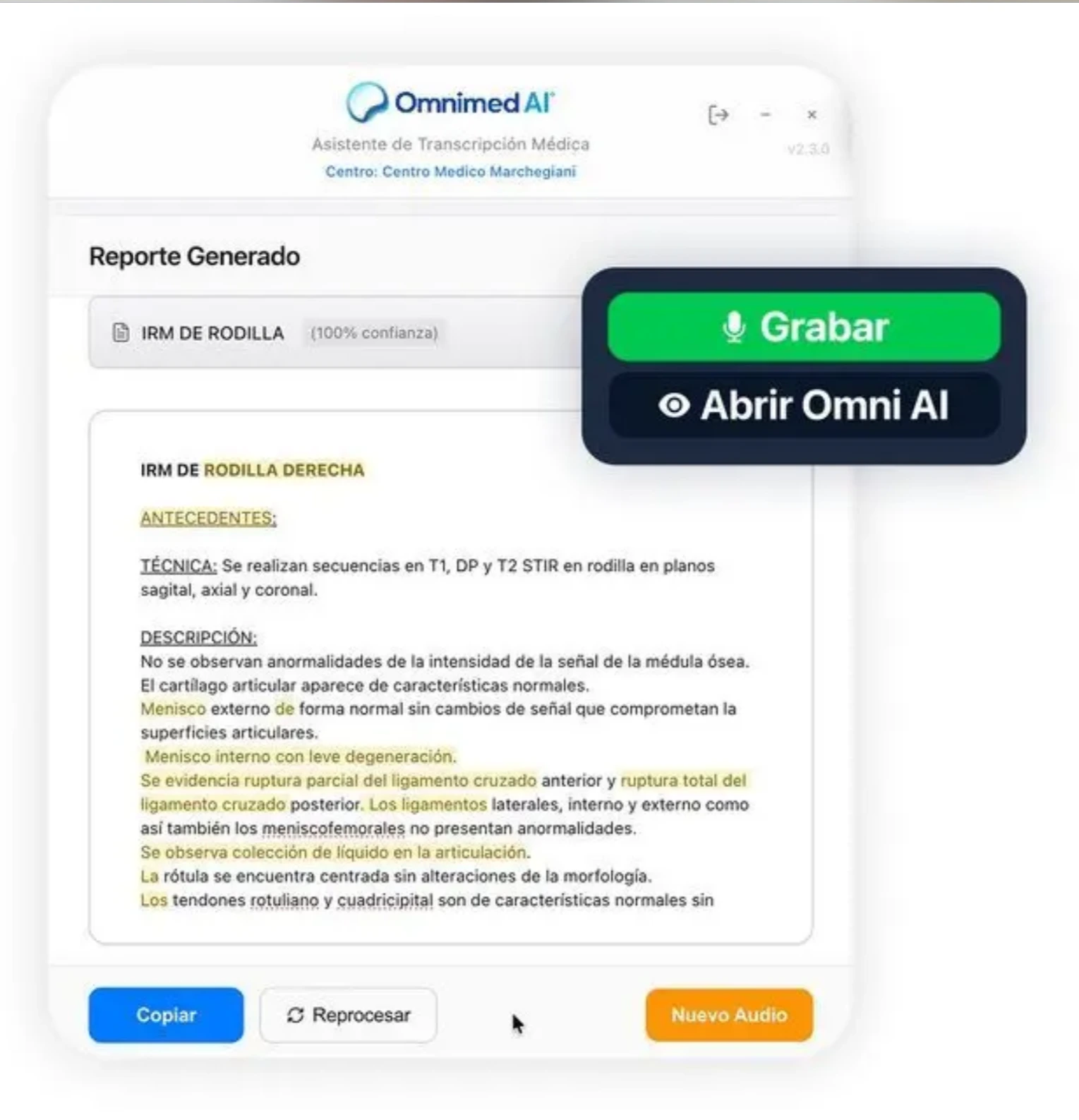 Interfaz correspondiente a la aplicación Omnimed AI, desarrollada por una startup cordobesa.