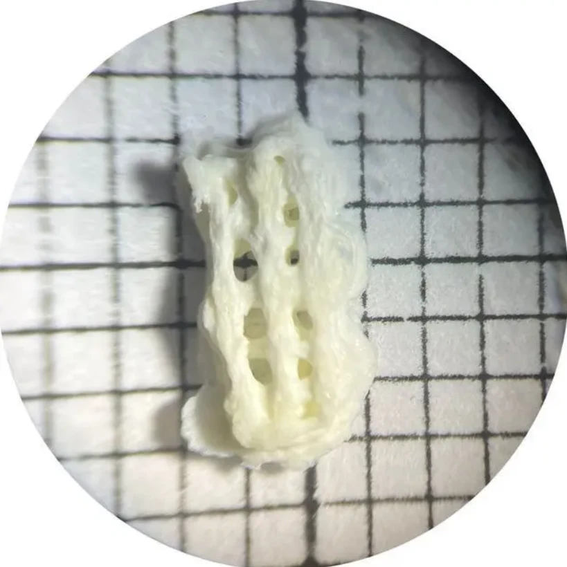 Parches oculares con impresión 3D para el tratamiento del galucoma