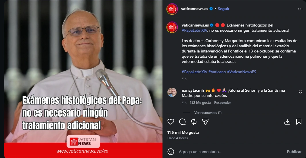 La información oficial de la salud del Papa