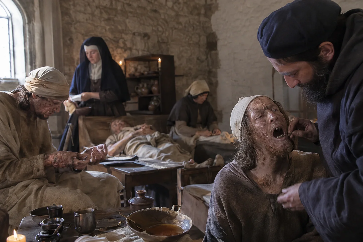 Detectan mercurio en dientes de leprosos medievales y revelan cómo eran tratados hace 900 años