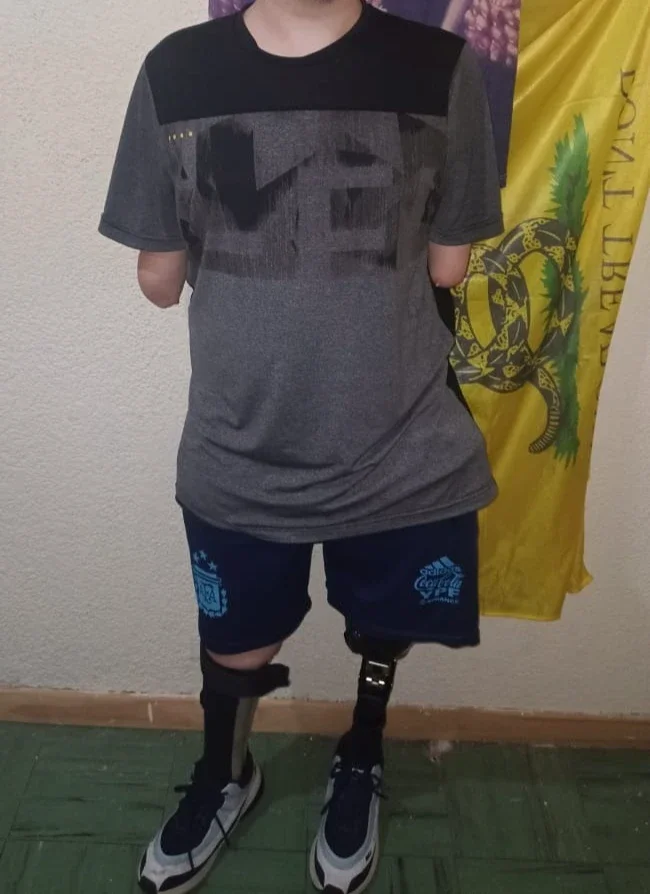Pese al odio del militante kirchnerista, el jóven liberal logró conseguir su prótesis