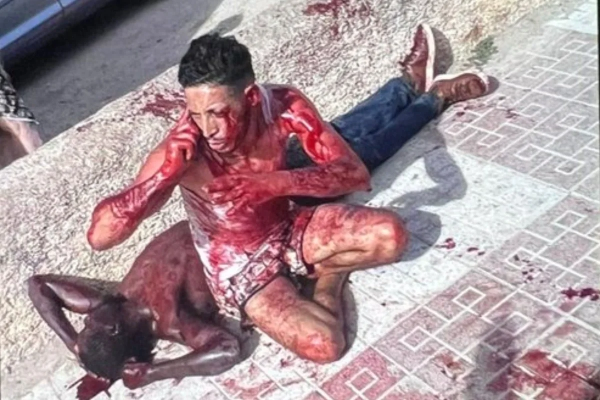 España: un magrebí le abrió la cabeza a un hombre con un martillo y le cortó el cuello a otro con una botella