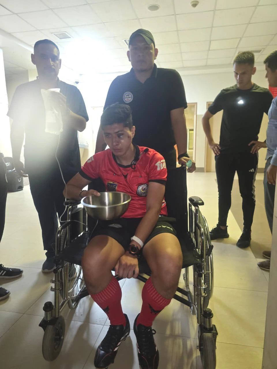 Así quedó el árbitro Lenin Ojeda tras el piedrazo recibido