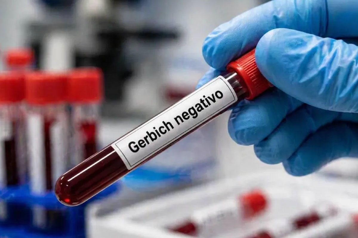 Qué es el grupo sanguíneo Gerbich negativo