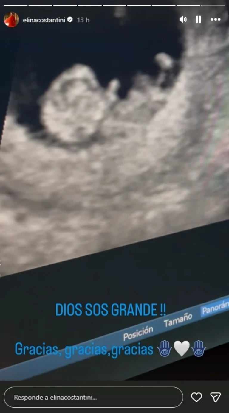 La imagen con la que la pareja presentó a su nuevo hijo en camino